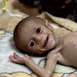 FEED GAZA (GAZA)